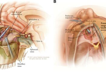 Neurosurgery