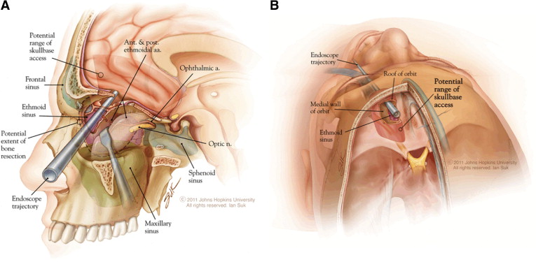 Neurosurgery